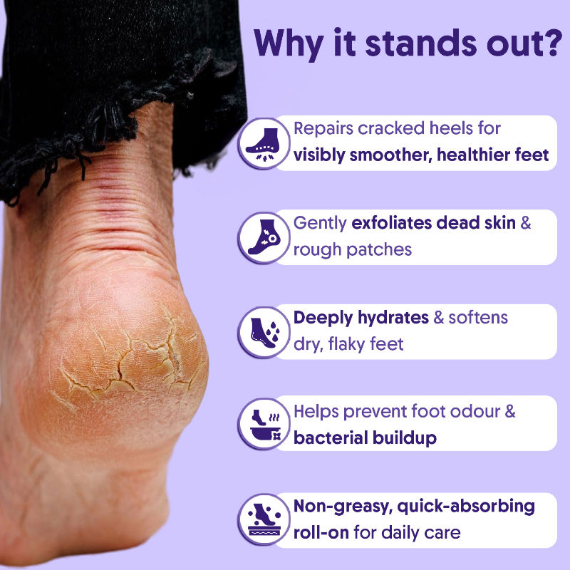 Aravi Organic 20% Urea Foot & Heel Roll On For Dry Feet & Cracked Heels,Repairs & Softens Rough Skin