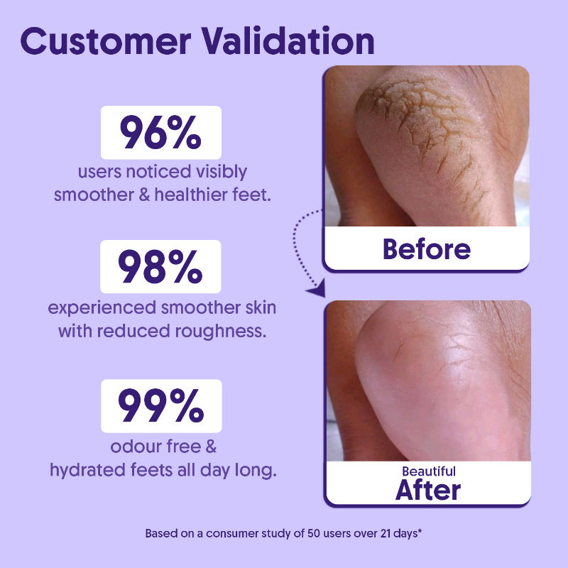 Aravi Organic 20% Urea Foot & Heel Roll On For Dry Feet & Cracked Heels,Repairs & Softens Rough Skin
