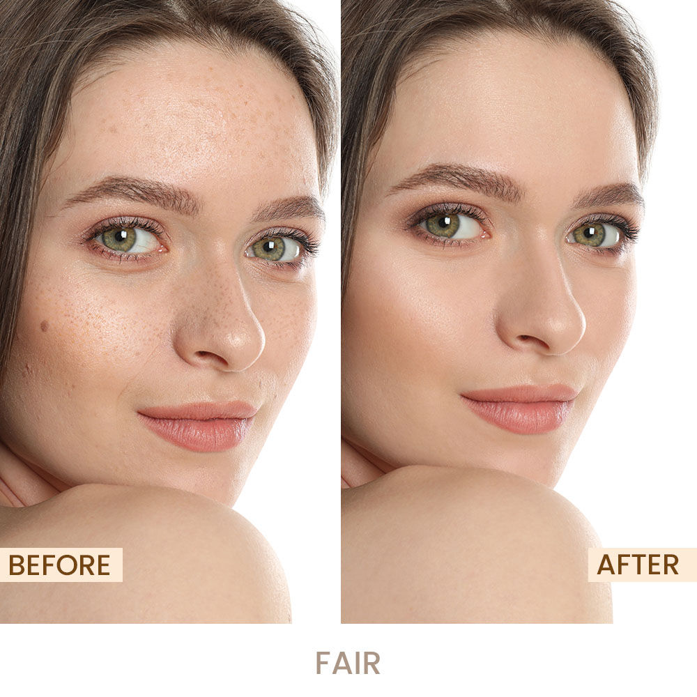 Shopaarel Miracle Skin Foundation