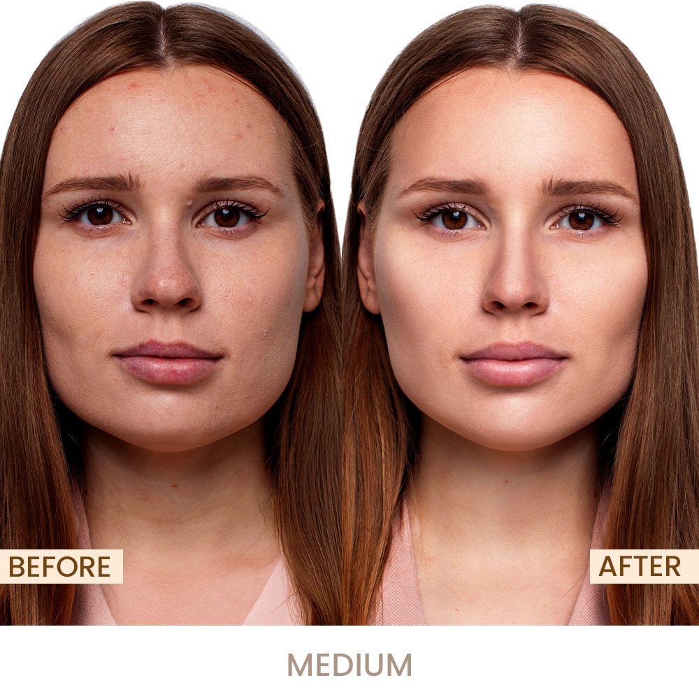 Shopaarel Miracle Skin Foundation
