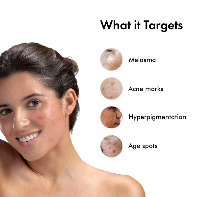 Suganda Advance Pigmentation Face Serum with Arbutin +Tranexamic Acid, Fights Hyperpigmentation