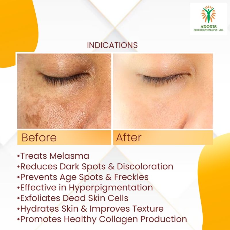 Adonis Unisex Ad Mela Tx Face Serum With Tranexamic Acid & Kojic Acid For Dark Spots & Even Tone