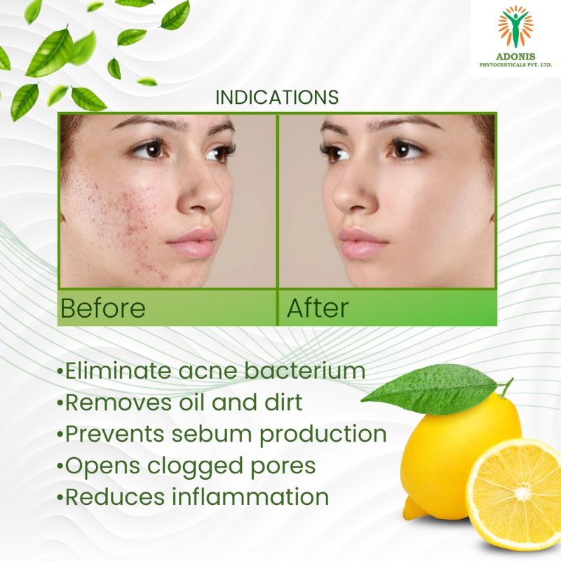 Adonis Unisex Ds Anti Acne Face Wash Cleanser With Salicylic Acid & Minerals For Oil Control & Acne