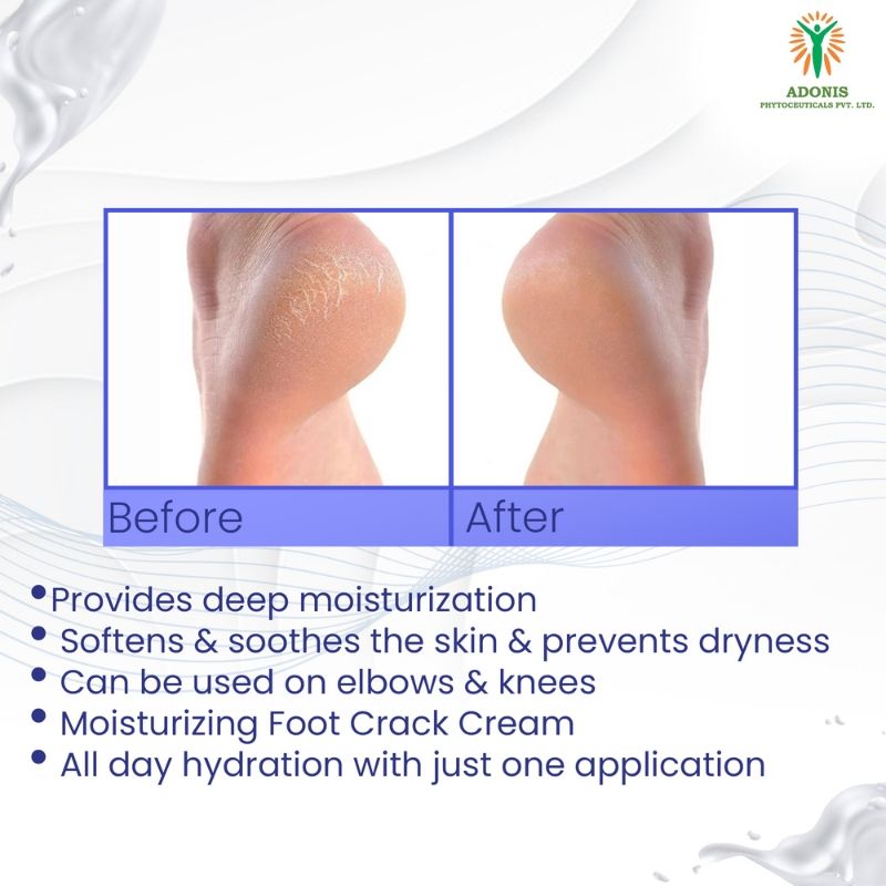 Adonis Unisex Ds Soft Cream Foot Repair Cream With Urea & Lactic Acid For Cracked Heels, Smooth Skin
