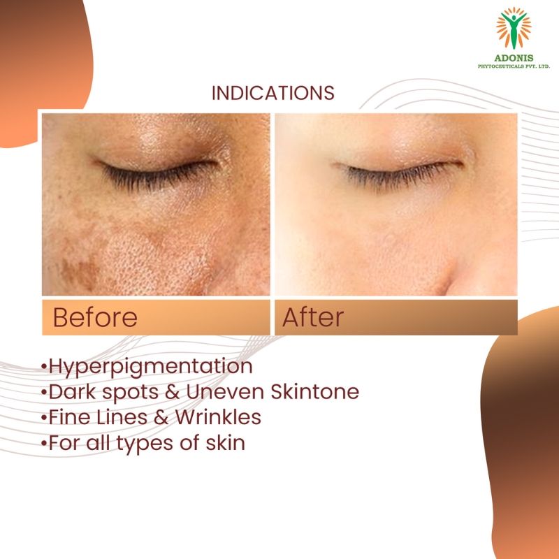 Adonis Unisex Adozelic AZ Face Serum with Azelaic Acid & Niacinamide for Pigmentation & Even Tone