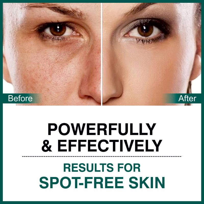 She Essentials Dark Spot Corrector Cream, Niacinamide & Vitamin E Oil
