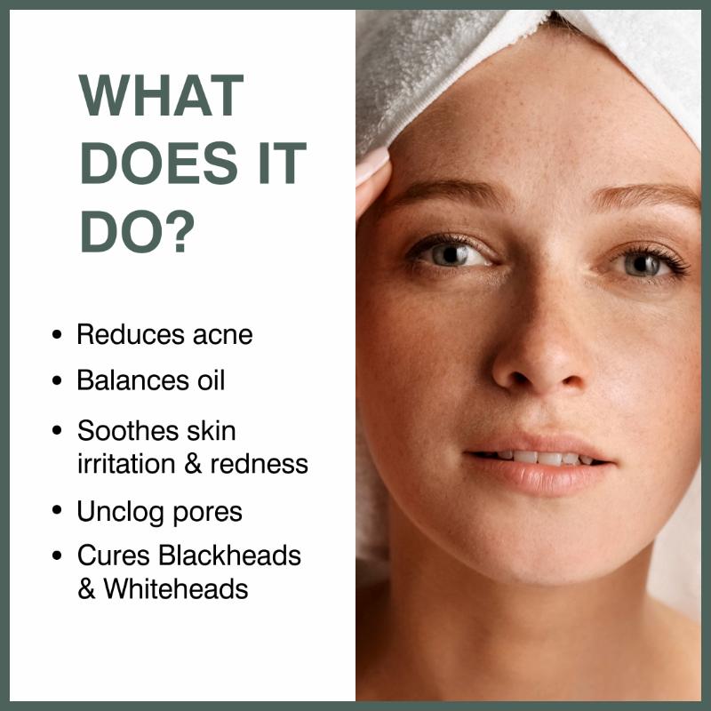 She Essentials 2% Salicylic Acid Serum For Face For Active Acne