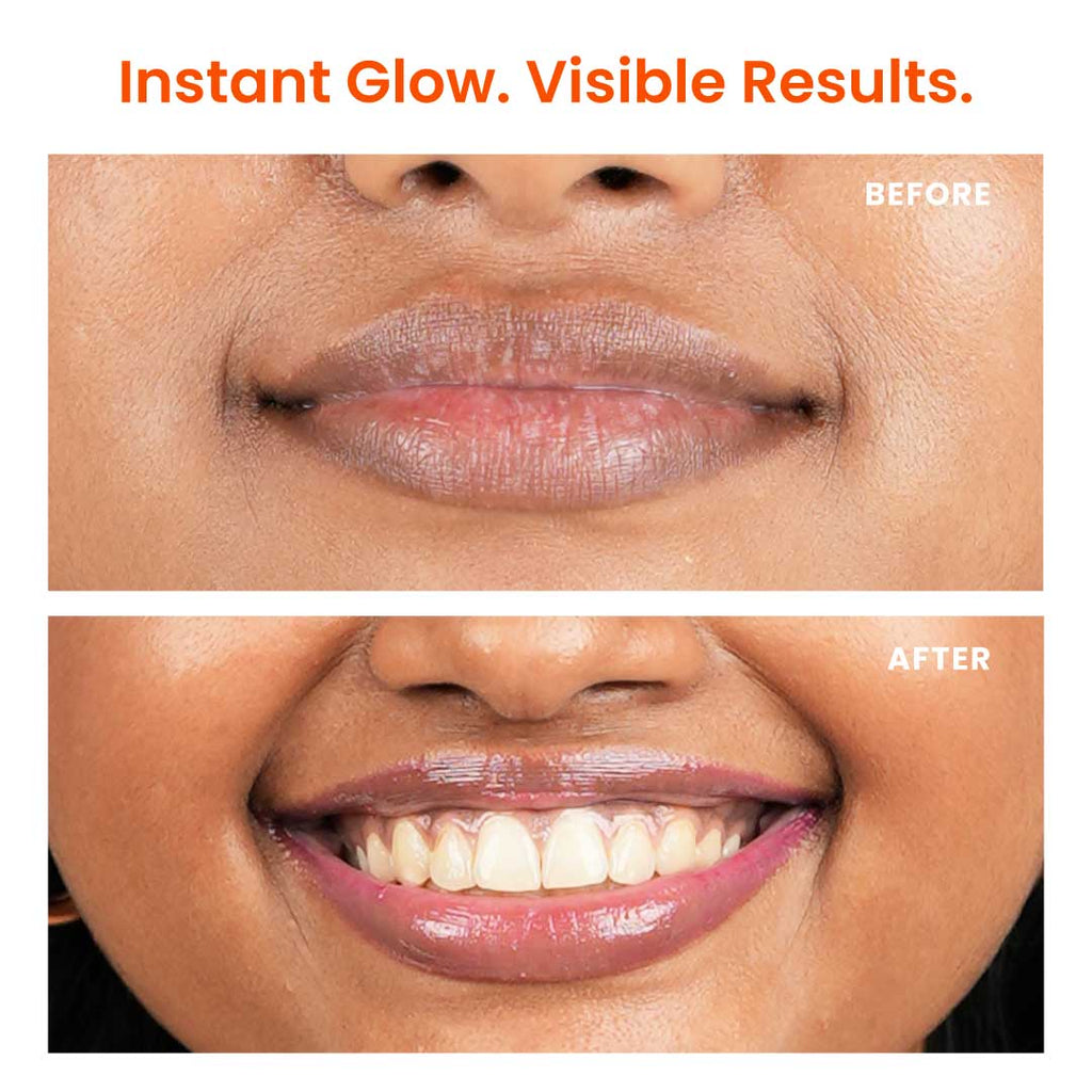 Foxtale Brightening Lip Balm with Peptides, Vitamin C & Hyaluronic Acid for Dry Lips & Pigmentation
