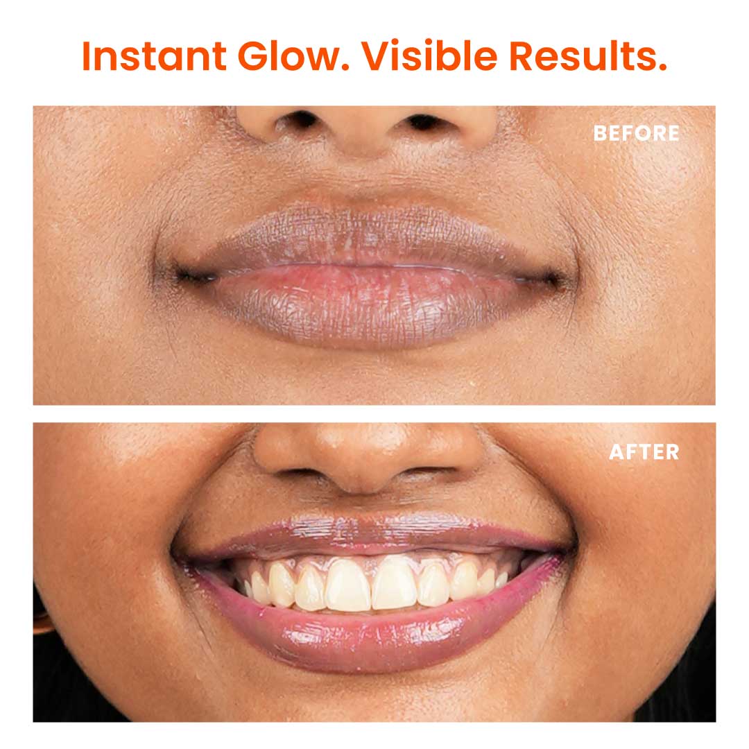 Foxtale Brightening Lip Balm with Peptides, Vitamin C & Hyaluronic Acid for Dry Lips & Pigmentation