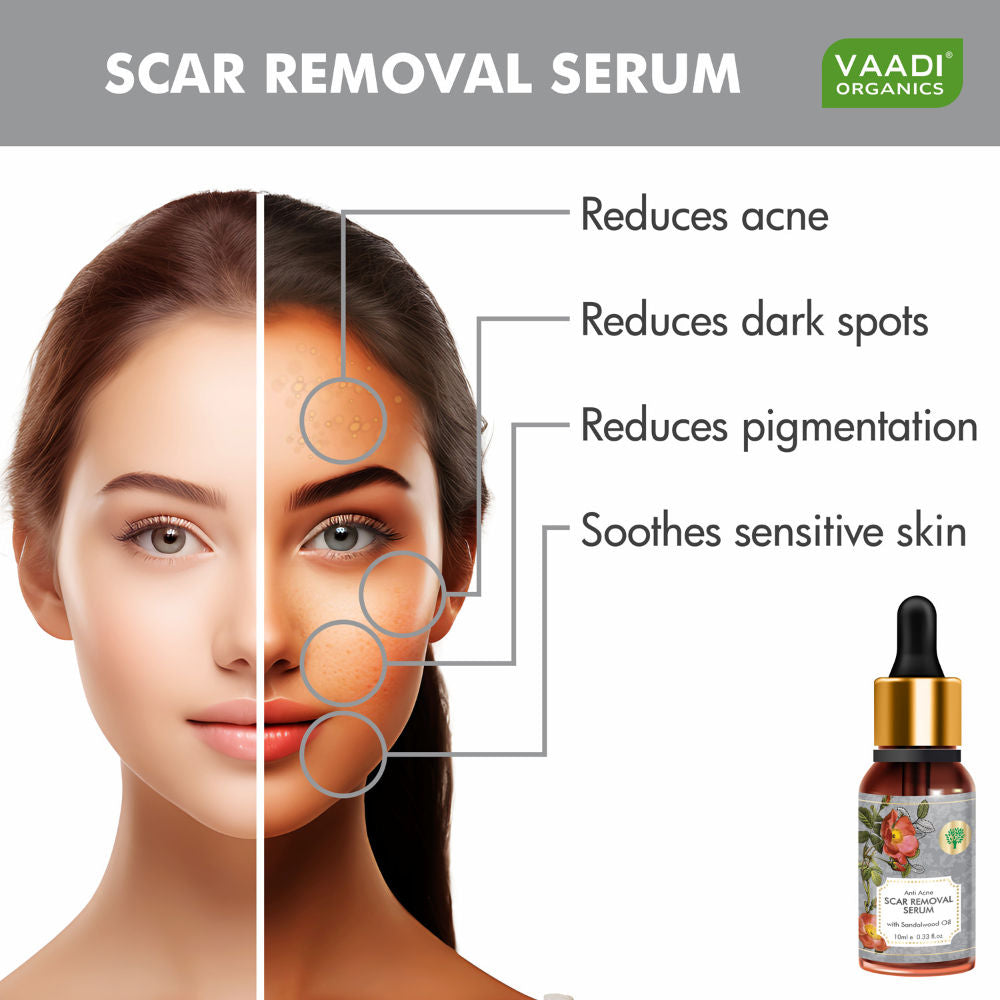 Vaadi Herbals Anti Acne Scar Removal Serum With Sandalwood Oil