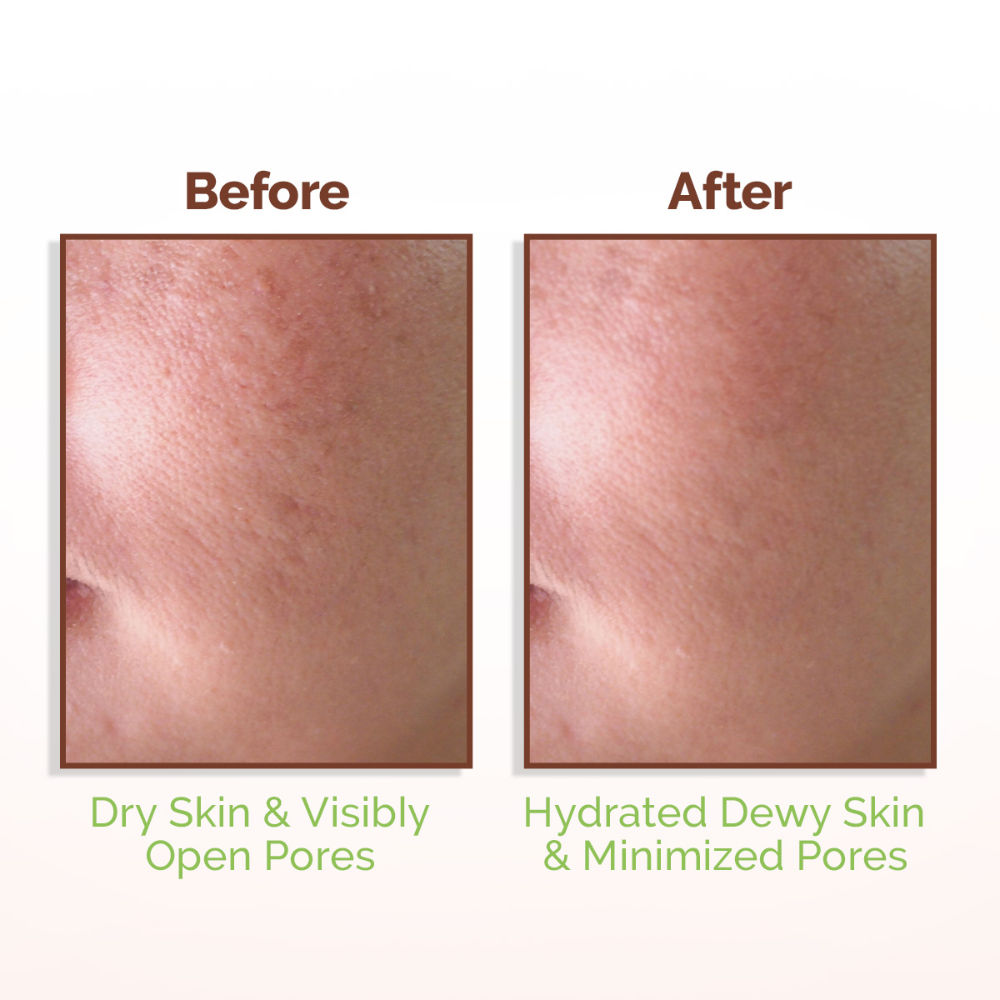 Mamaearth Rice Water Dewy Face Toner with 4% Niacinamide for Glass Skin and All Skin Types