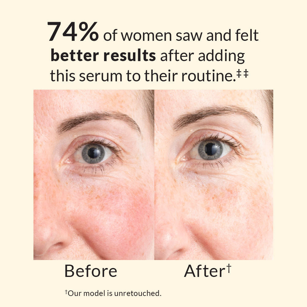Avon Anew Skin Renewal Power Serum