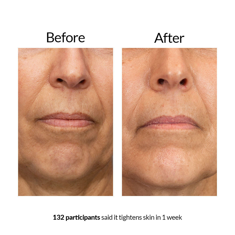 Avon Anew Platinum Lift & Tighten Lifting Serum
