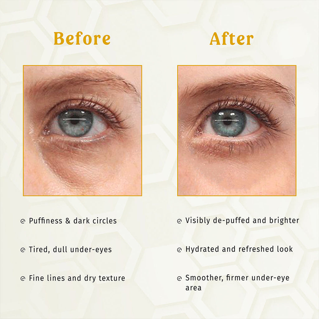 TBC - The Bath and Care Gold E-Care Gel Eye Mask Reduces Dark Circles Hydrating, Brightening