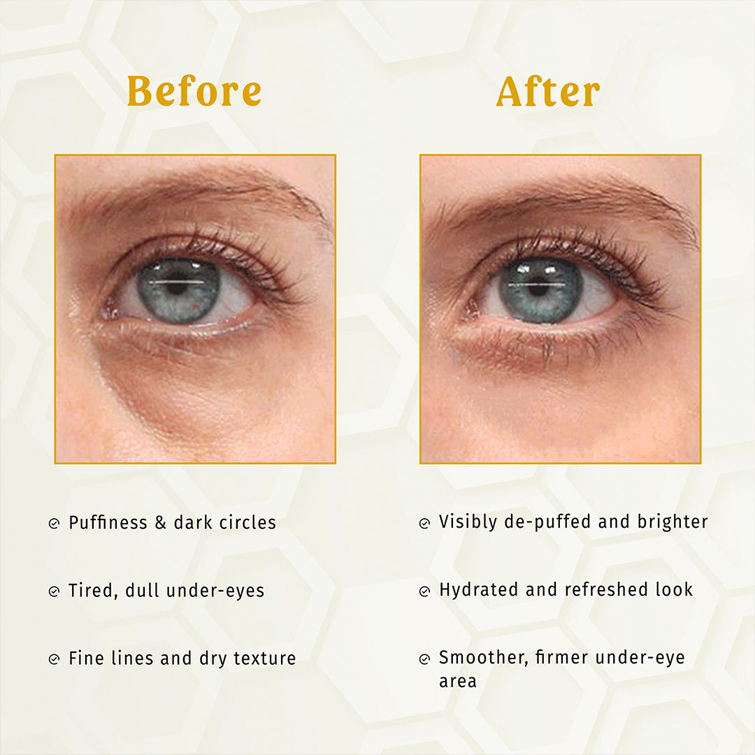 TBC - The Bath and Care Gold E-Care Gel Eye Mask Reduces Dark Circles Hydrating, Brightening