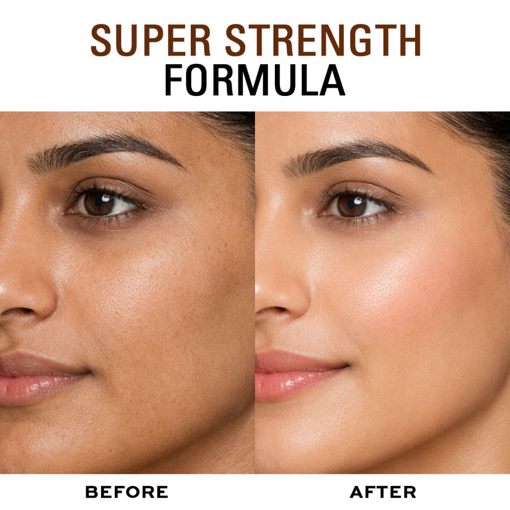 Makeup Revolution Skincare 0.5% Retinol Super Serum With Rosehip Seed Oil