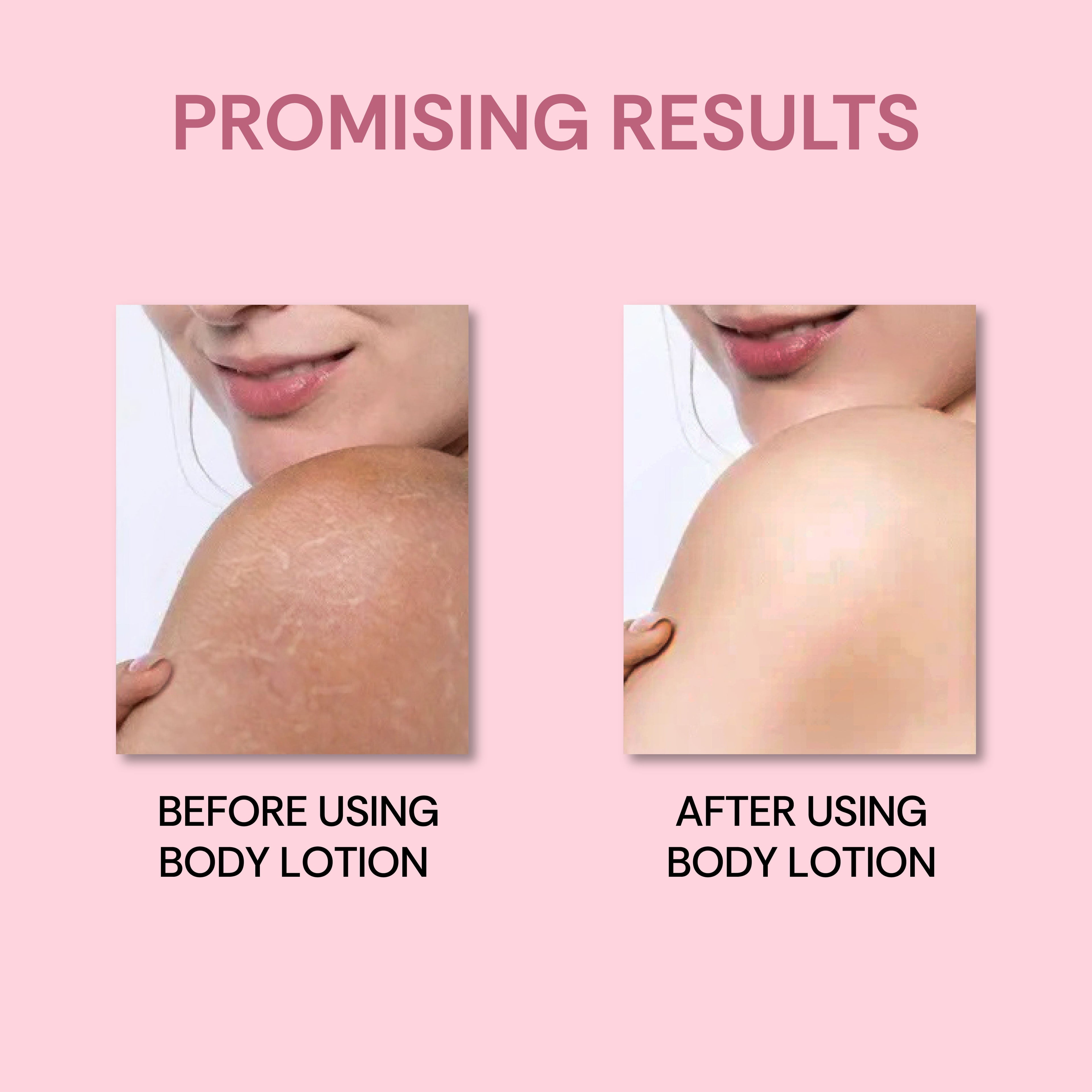 Vedic Valley Snehana Pushp Body Lotion