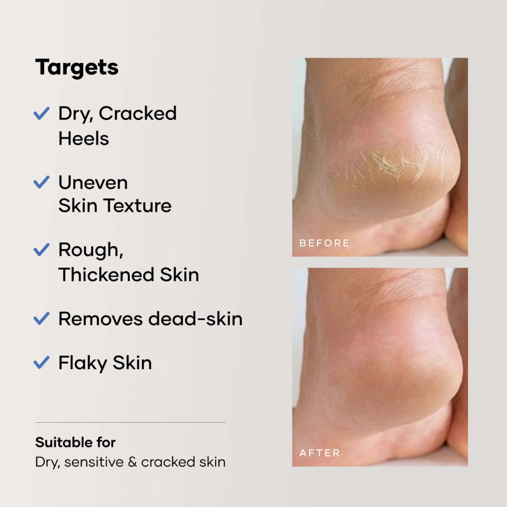 Cureskin Foot Care Cream for Cracked Heels