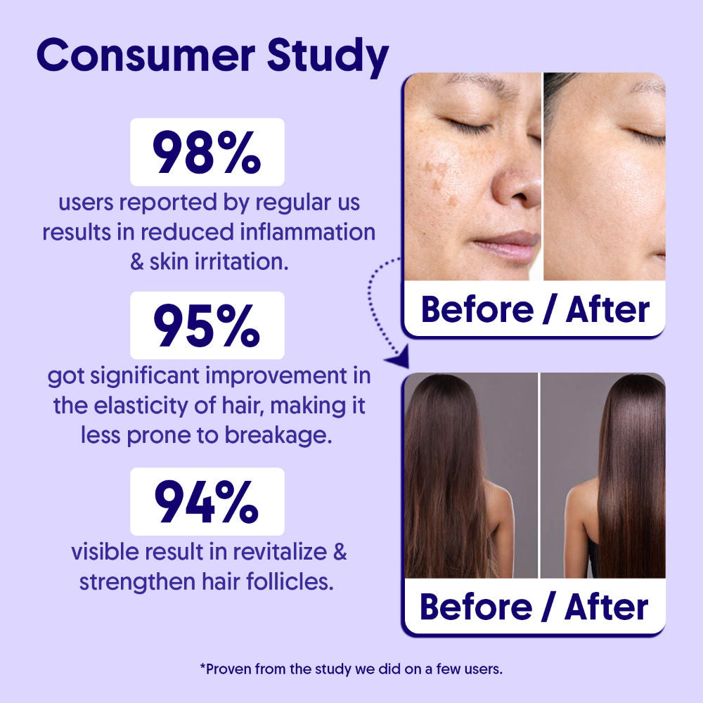 Aravi Organic 100% Pure Lavender Essential Oil For Healthy Hair Growth, Skin, & Sleep