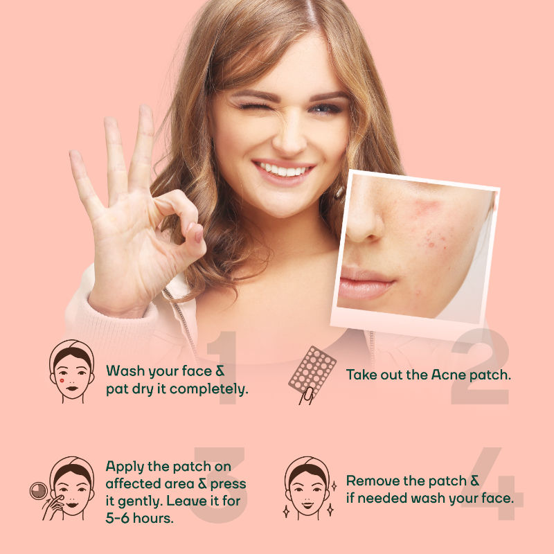 Mountainor Teen Acne Pimple Patch Strips, Salicylic Acid + Tea Tree Oil Clean & Clear Spot Corrector