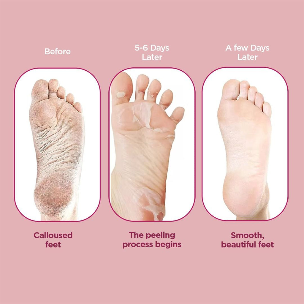 FURR Glycolic & Salicylic Acid Exfoliating Foot Peeling Mask - Reduces Dry Skin
