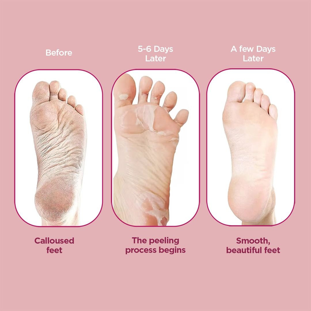 FURR Glycolic & Salicylic Acid Exfoliating Foot Peeling Mask - Reduces Dry Skin