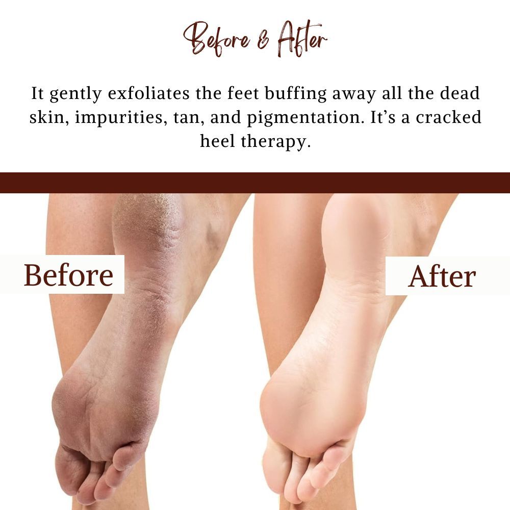 BodyHerbals Foot Scrub - 1 minute pedicure
