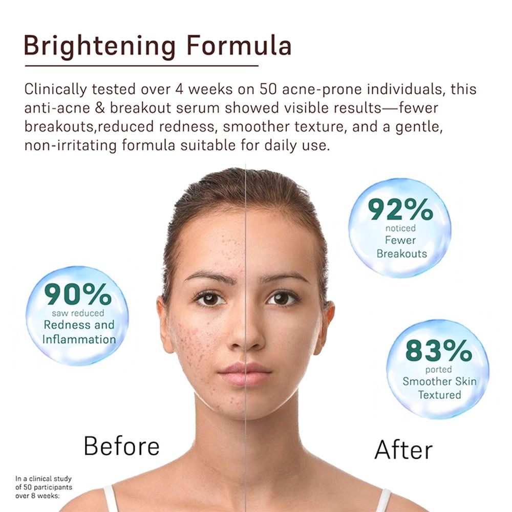 COAL Clean Beauty Anti-Acne And Breakouts Face Serum