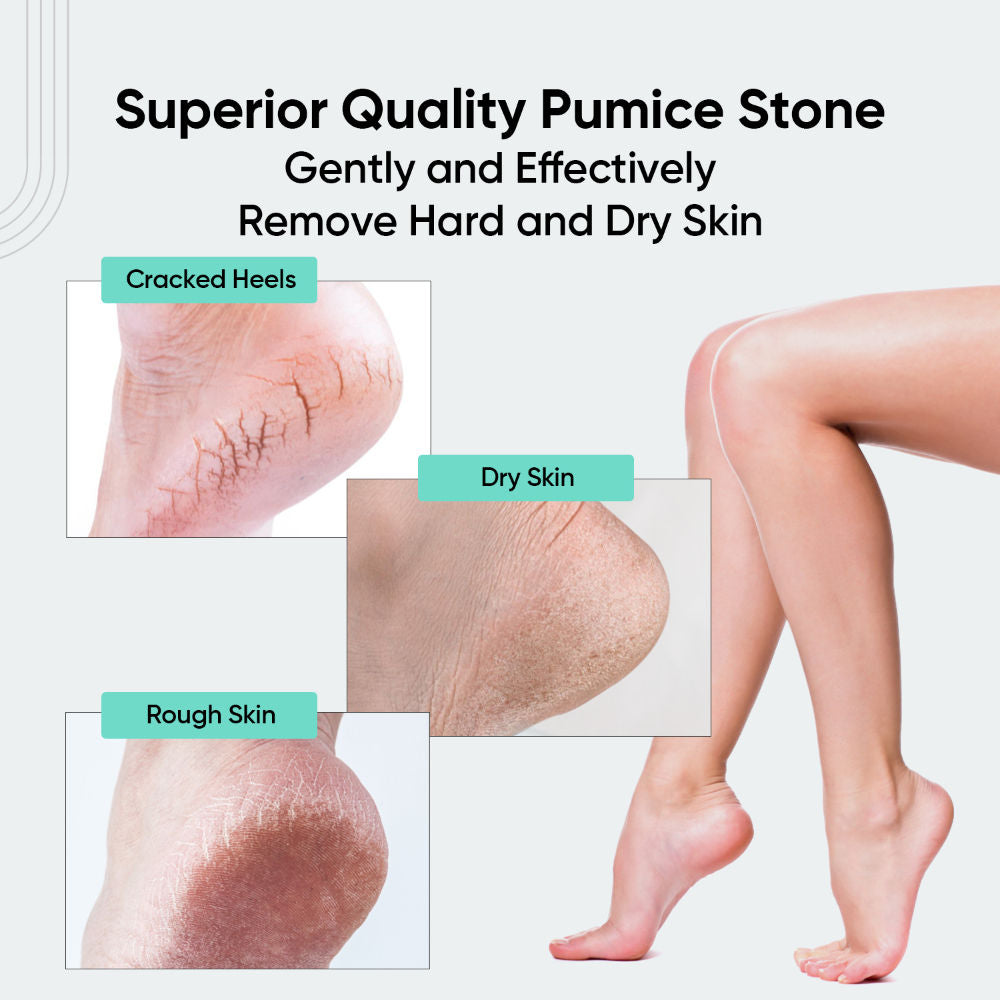 VEGA Pumice Stone (PD16) (Colour May Vary)