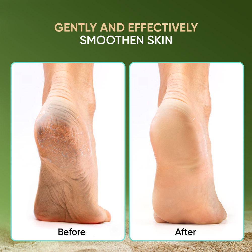Vega 3 In 1 Pedicure Tool- Callus Remover & Pedicure Tool For Wet & Dry Feet - PD 20