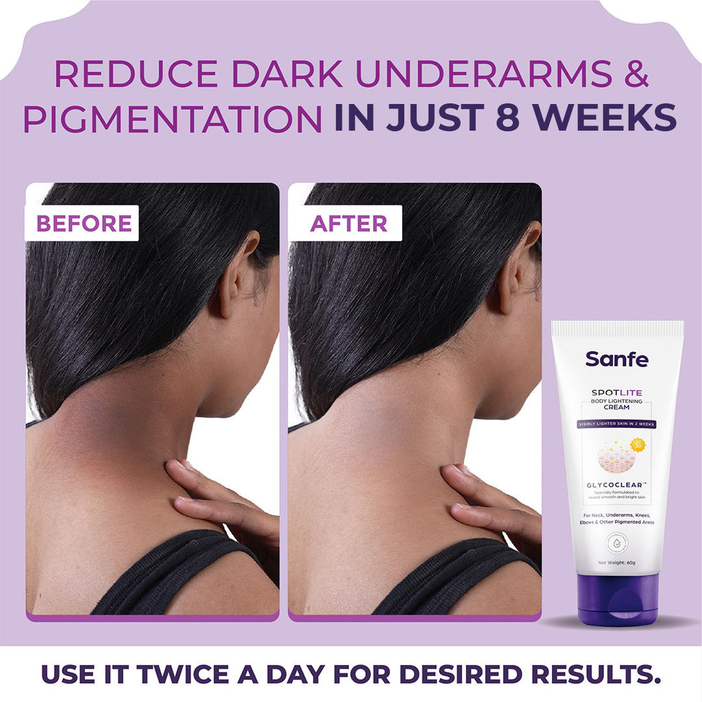 Sanfe spotlite body lightening Cream