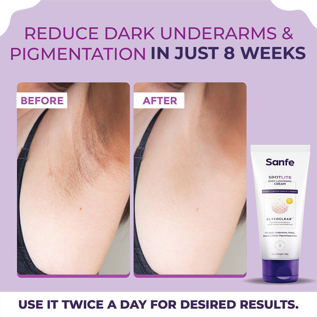 Sanfe spotlite body lightening Cream