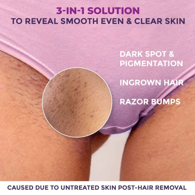 Sanfe Spotlite Ingrown Hair & Bumps Clearing Body Scrub For Dark Underarms, 10% Glycolic Acid