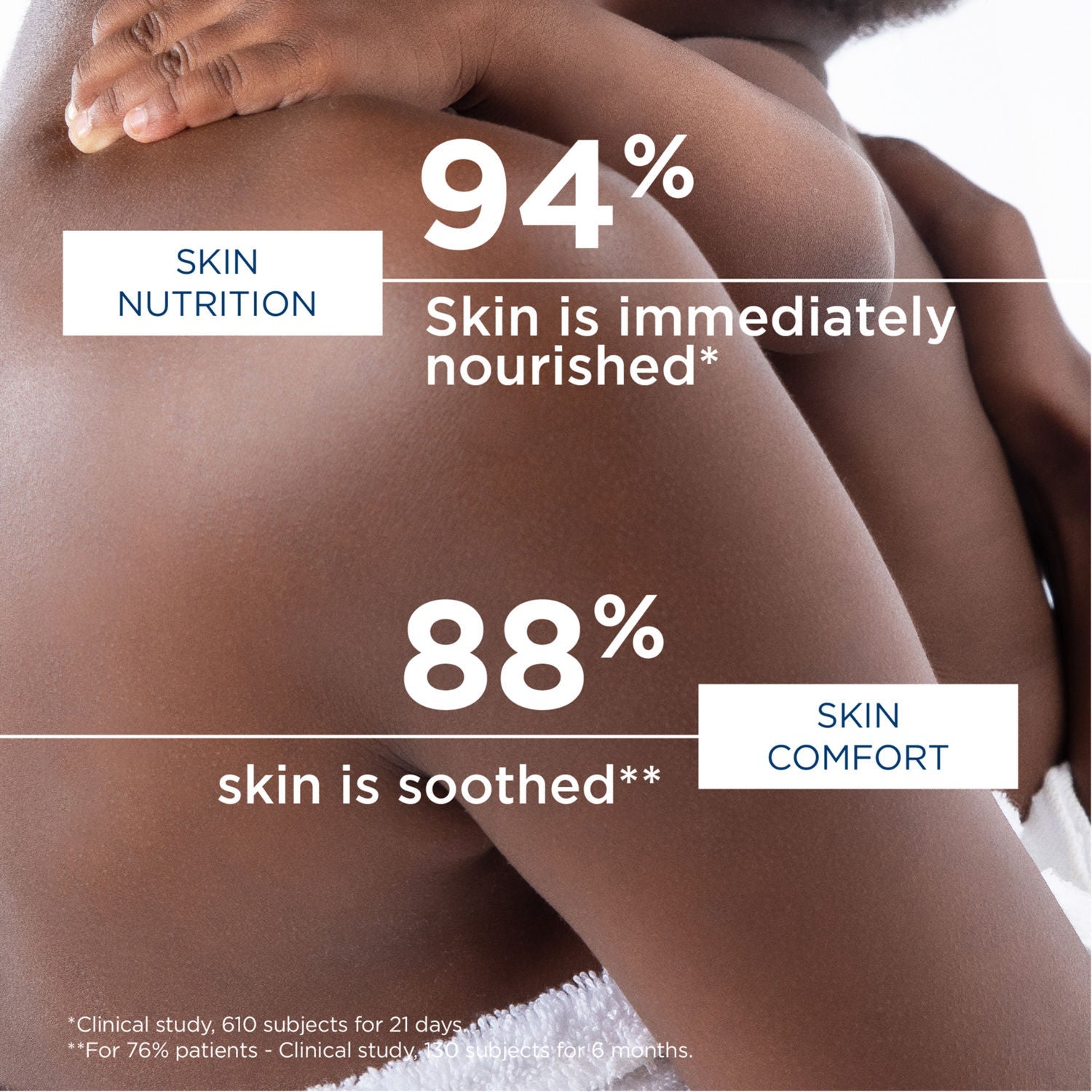 Bioderma Anti-Itching Balm-Atoderm Intensive Baume-Ceramides & Canola Oil-Eczema Prone Skin