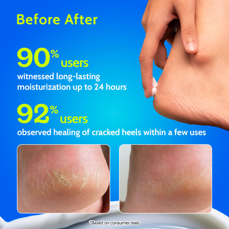 Chemist At Play 10% Urea Foot Cream For Cracked Heels & Diabetic Foot Up to 24 Hours Of Moisturization
