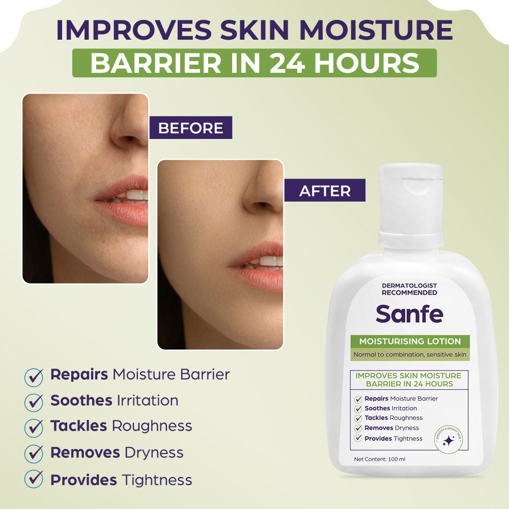 Sanfe Moisturising Lotion | Improves skin moisture barrier in 24 hours | For all skin types | 100ml