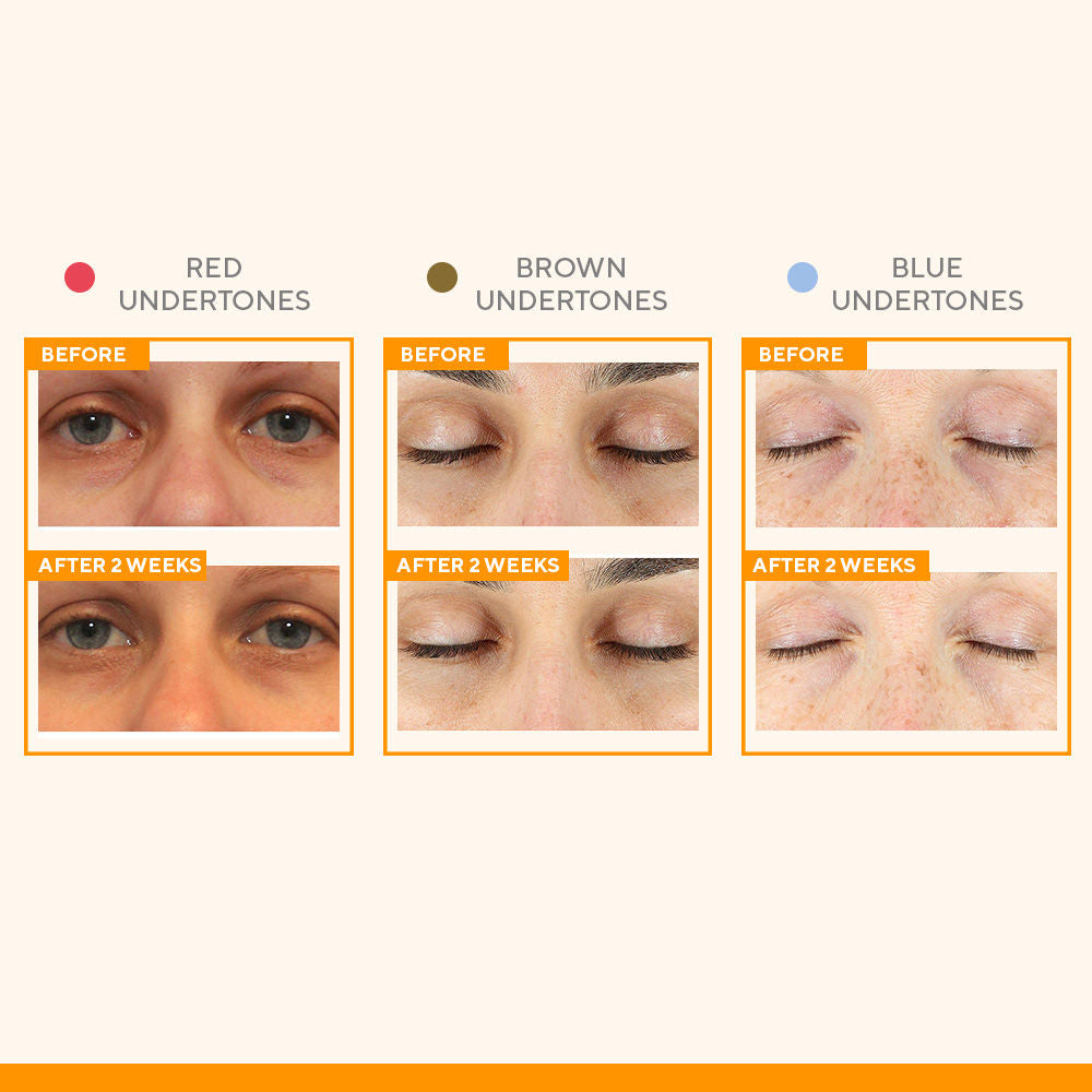 Murad Vitamin C Eyes Dark Circle Corrector