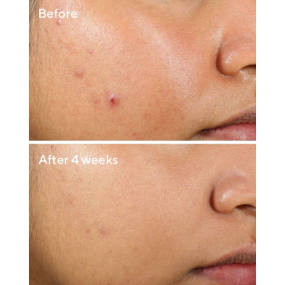 Murad Clarifying Water Gel