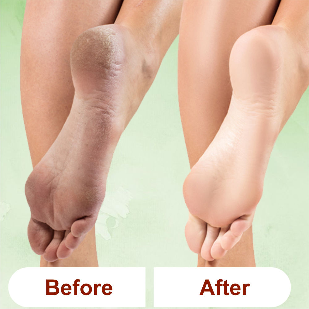 Kazarmaa Lemon Grass Foot Scrub For Home Pedicure With Natural Oils And Foot Scrubber Tool
