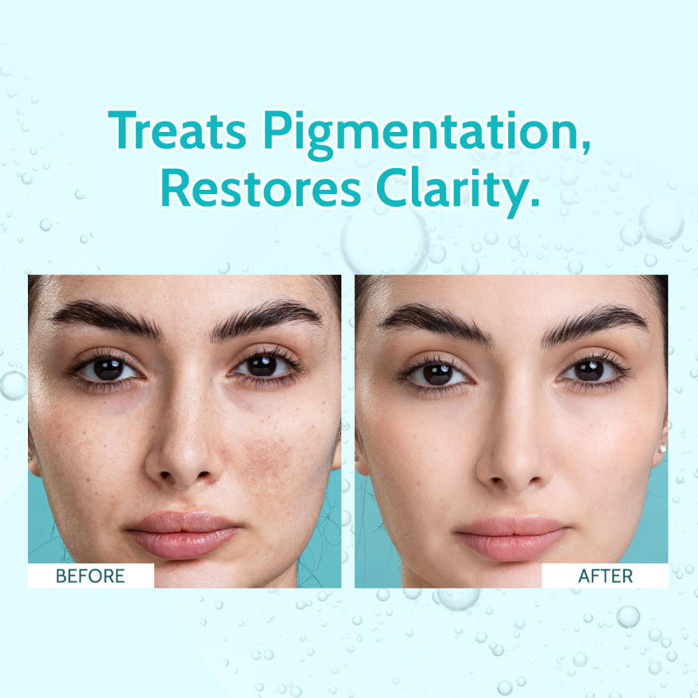 Chemist at Play Clarifying Serum, 10% Niacinamide, 3% Tranexamic Acid, For Clear & Spotless Skin