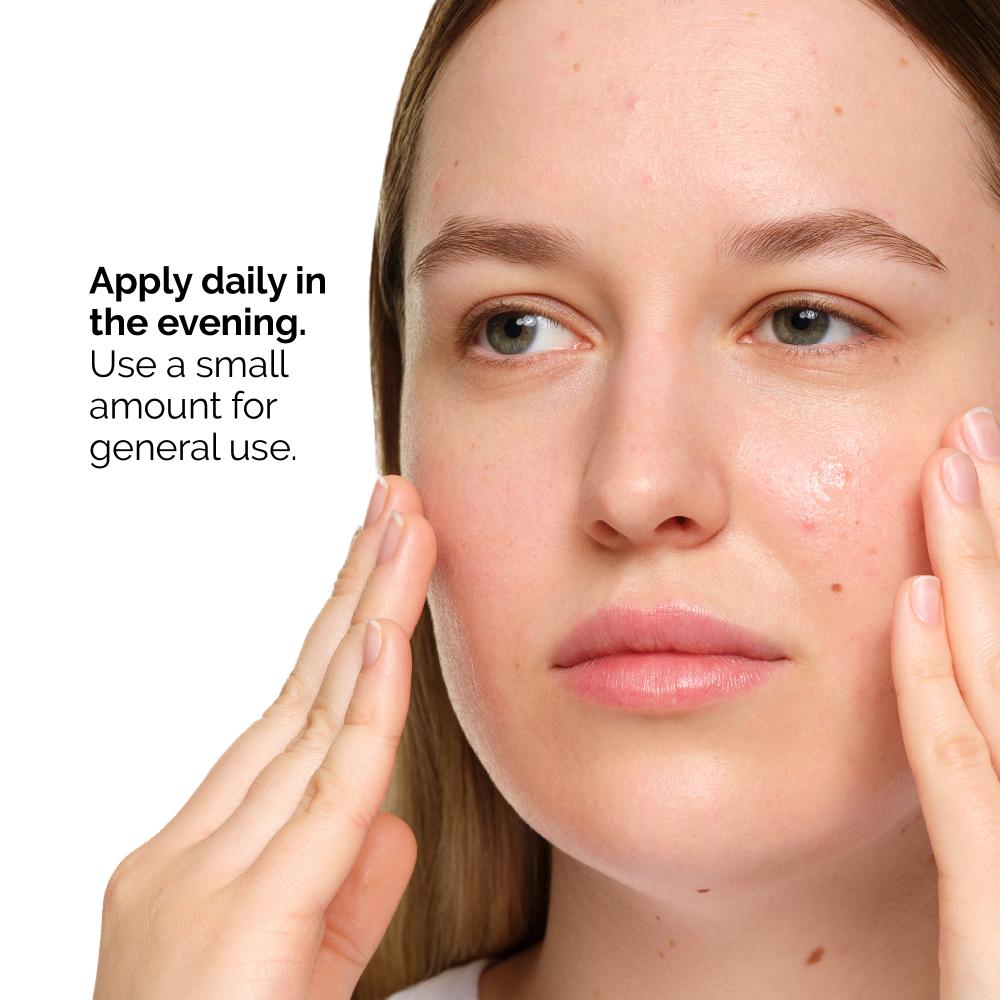 The Ordinary Salicylic Acid 2% Anhydrous Solution