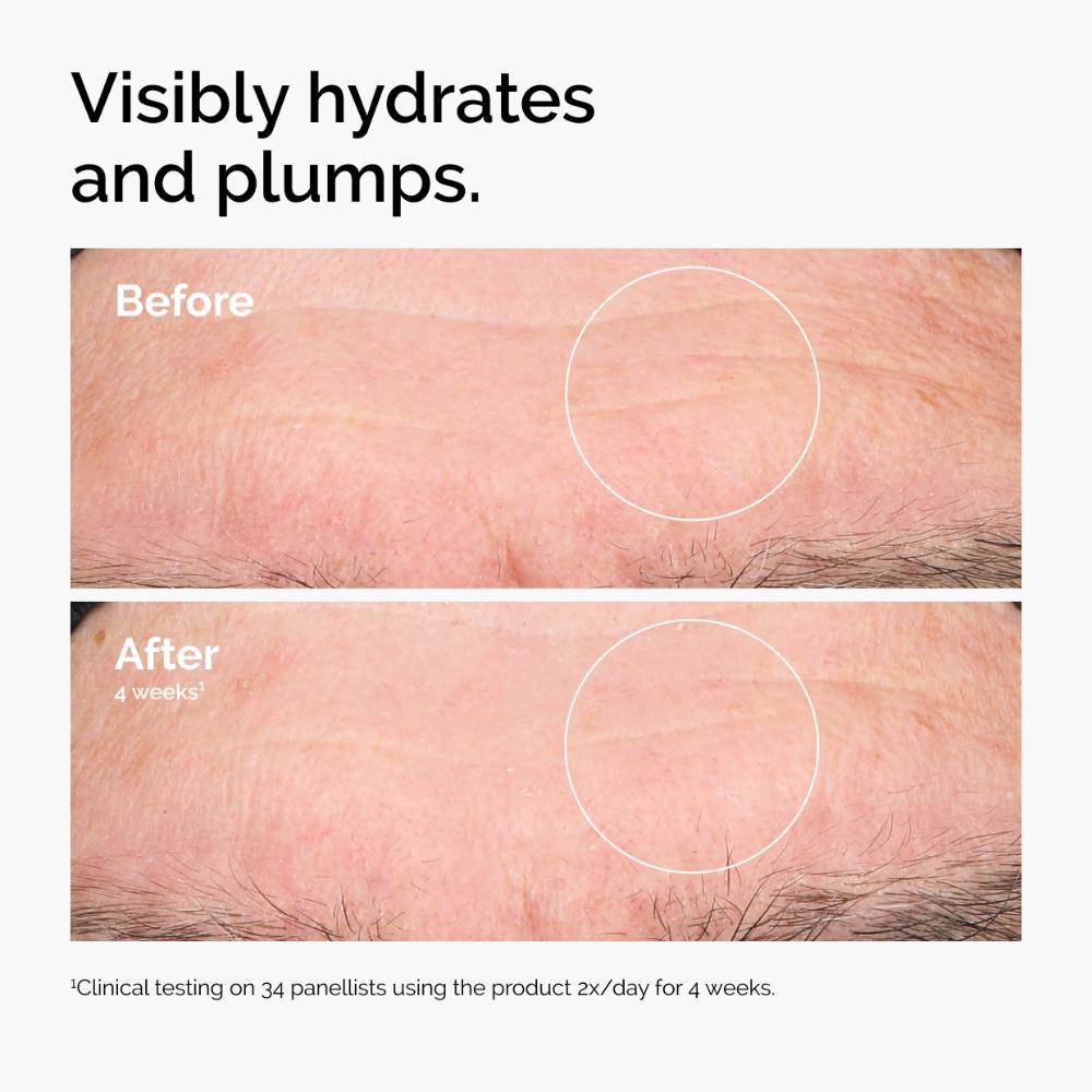 The Ordinary Hyaluronic Acid 2% + B5