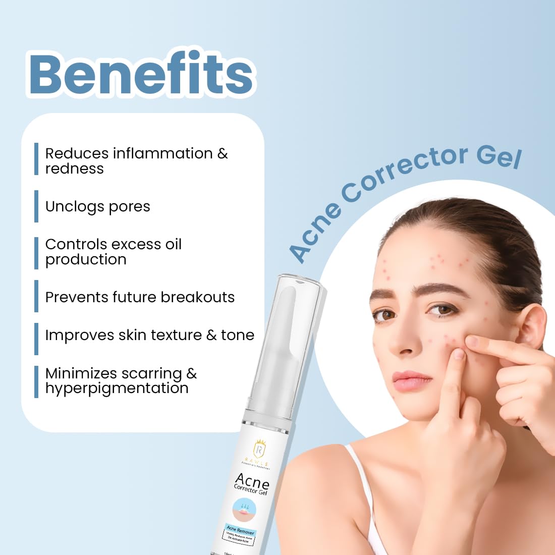 RAWLS Acne Corrector Gel For Active Acne & Redness