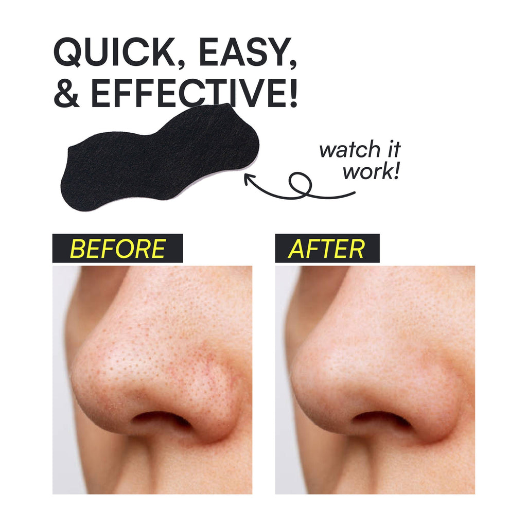 Gush Beauty Nose Pore Patches - Charcoal
