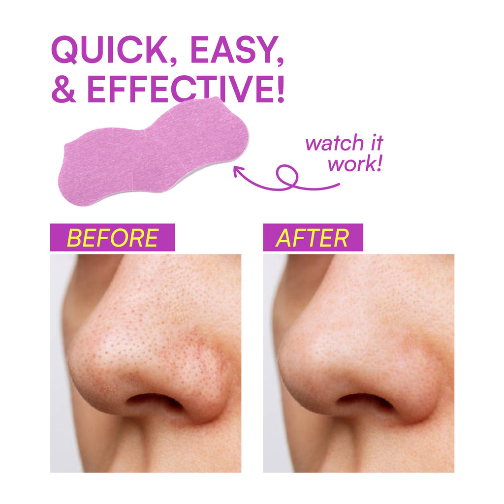 Gush Beauty Nose Pore Patches - Lavender