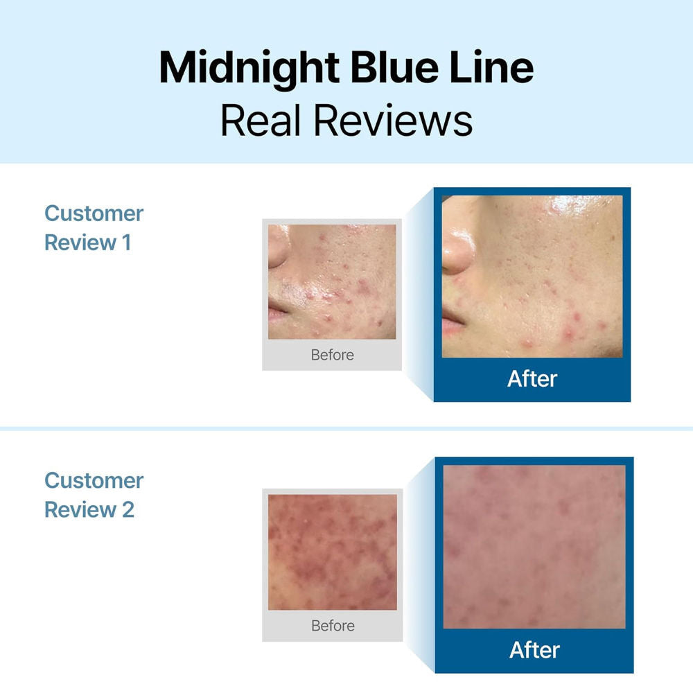 Klairs Midnight Blue Calming Cream