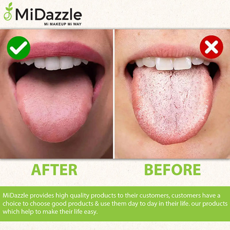 Midazzle Stainless Steel Tongue Cleaner for Men and Women with Brass Handle Adults