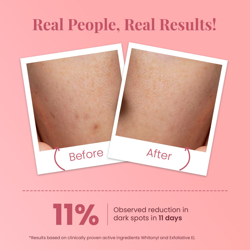 La Pink Ideal Bright Face Scrub For Flawless & Glowing Skin, Gentle Exfoliation, All Skin Types