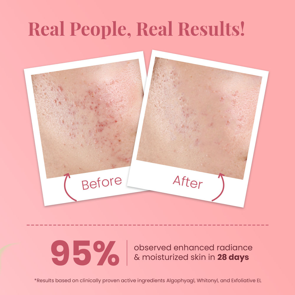 La Pink Ideal Bright Face Serum With Kakadu Plum For Hyperpigmentation & Dark Spot Reduction
