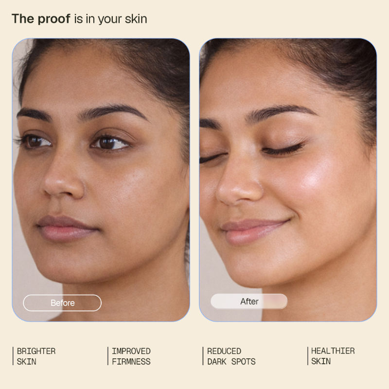 Arata Vitamin C Face Serum|Brightens, Targets Pigmentation & Supports Collagen